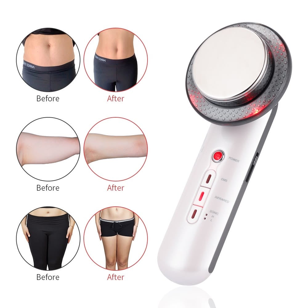 Ultrasonido Infrarrojo facial 3 en 1